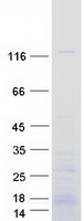 Coomassie blue staining of purified DHX30 protein