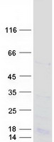 protq7l4i2 rsrc2 human recombinant protein