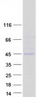 protq7lg56 p53r2 rrm2b human recombinant protein