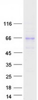 protq7rts9 dymeclin dym human recombinant protein