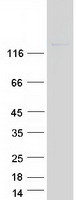 protq7rtw8 otoa human recombinant protein