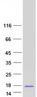 Coomassie blue staining of purified SMIM15 protein