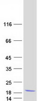 Coomassie blue staining of purified COMMD6 protein