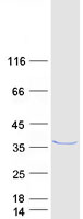 Coomassie blue staining of purified ABHD12B protein