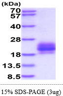 3ug by SDS-PAGE under reducing condition and visualized by coomassie blue stain