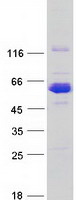 Coomassie blue staining of purified CCDC91 protein