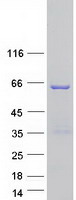 Coomassie blue staining of purified TSEN54 protein