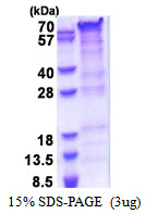 3ug by SDS-PAGE under reducing condition and visualized by coomassie blue stain.