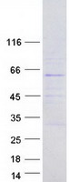 protq7z6m2 fbxo33 human recombinant protein