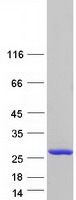 protq7z6v5 adat2 human recombinant protein
