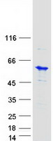 Coomassie blue staining of purified UBE2Q1 protein
