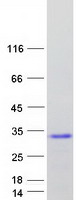 Coomassie blue staining of purified CPLX4 protein