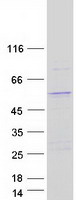 Coomassie blue staining of purified VPS13B protein