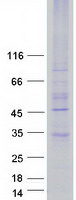 protq86sm8 gpcr mrge mrgpre human recombinant protein