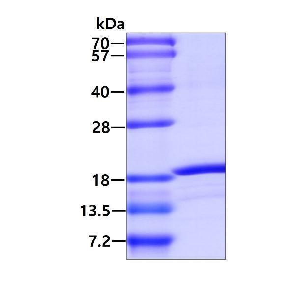 protq86sx6 sdspage human glrx5 recombinant protein_1