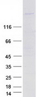 protq86tc9 mypn human recombinant protein