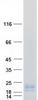 protq86u28 hbld1 isca2 human recombinant protein