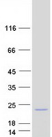 protq86uw2 ost beta slc51b human recombinant protein