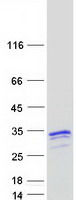 Coomassie blue staining of purified NAA40 protein
