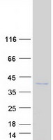 protq86v86 pim3 human recombinant protein