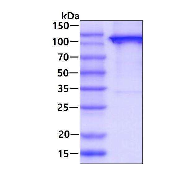 3ug by SDS-PAGE under reducing condition and visualized by coomassie blue stain