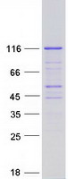 Coomassie blue staining of purified PACS2 protein