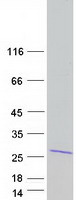 protq86vx2 commd7 human recombinant protein