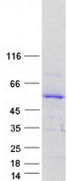 protq86vy4 tspyl5 human recombinant protein