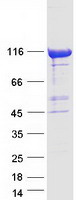 Coomassie blue staining of purified CHD1L protein