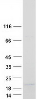 protq86ws3 plac1l oosp2 human recombinant protein