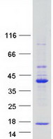 protq86wt6 rnf36 trim69 human recombinant protein