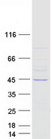 protq86x40 lrrc28 human recombinant protein