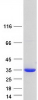 protq86x76 nit1 human recombinant protein