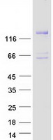 protq86xp1 dgkh human recombinant protein