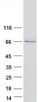protq86y22 col23a1 human recombinant protein
