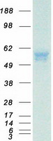 protq86yb8 ero1lb ero1b human recombinant protein