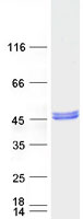 Coomassie blue staining of purified PDSS2 protein