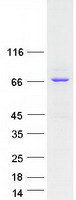 Coomassie blue staining of purified ANKRD13B protein
