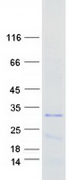 Coomassie blue staining of purified TDRP protein