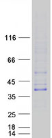 Coomassie blue staining of purified TREML1 protein