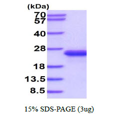 protq8bvz5 sdspage mouse il 33 recombinant protein