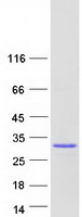 Coomassie blue staining of purified TGIF2LY protein