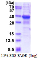 3ug by SDS-PAGE under reducing condition and visualized by coomassie blue stain.