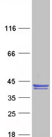 Coomassie blue staining of purified CLVS1 protein