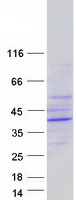 Coomassie blue staining of purified EPHX4 protein