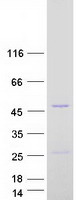 protq8iv20 c13orf31 lacc1 human recombinant protein