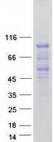 protq8ivh2 foxp4 human recombinant protein