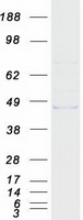 protq8ivh4 mmaa human recombinant protein
