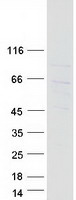 Coomassie blue staining of purified NOSTRIN protein