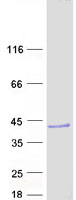 Coomassie blue staining of purified DCUN1D3 protein